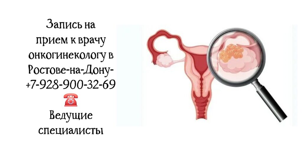 Онкогинеколог в Ростове-на-Дону - важная роль в диагностике и лечении рака