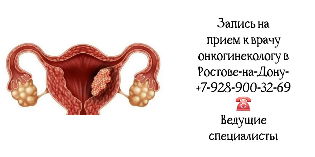 Онкогинеколог в Ростове-на-Дону - важная роль в диагностике и лечении рака