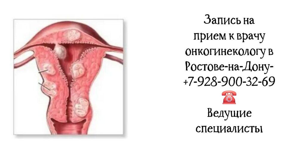Онкогинеколог в Ростове-на-Дону - важная роль в диагностике и лечении рака