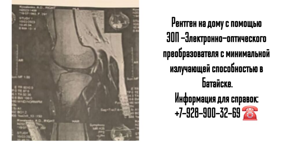 Батайск рентген на дому 