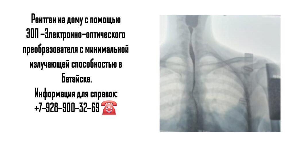 Батайск рентген на дому 