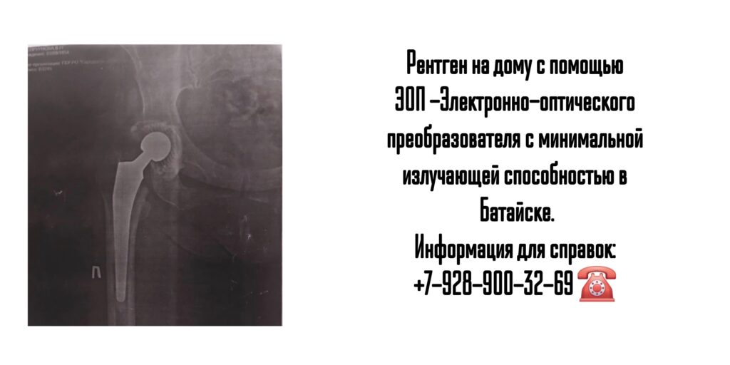 Батайск рентген на дому 