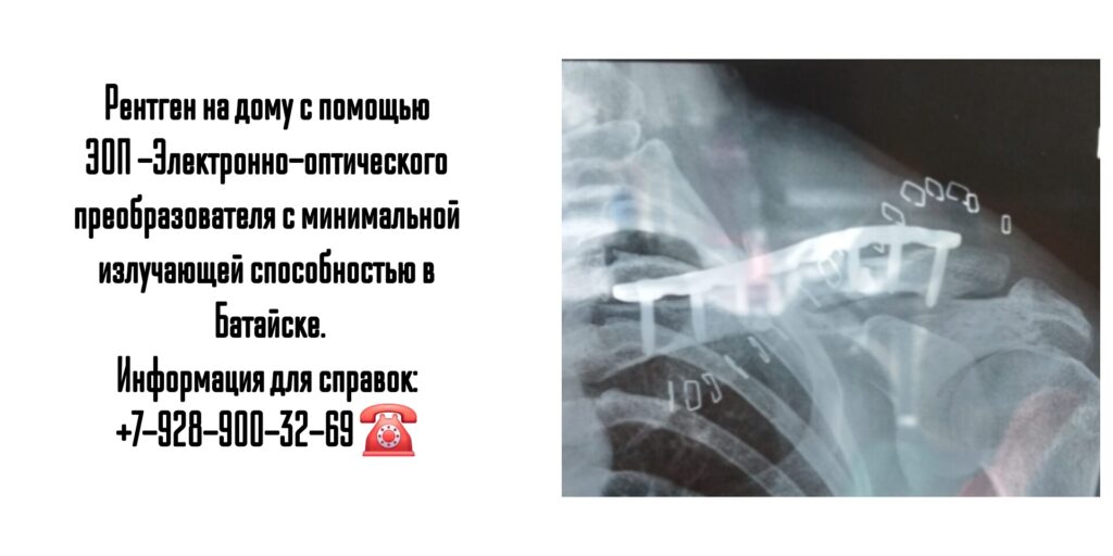 Батайск рентген на дому 