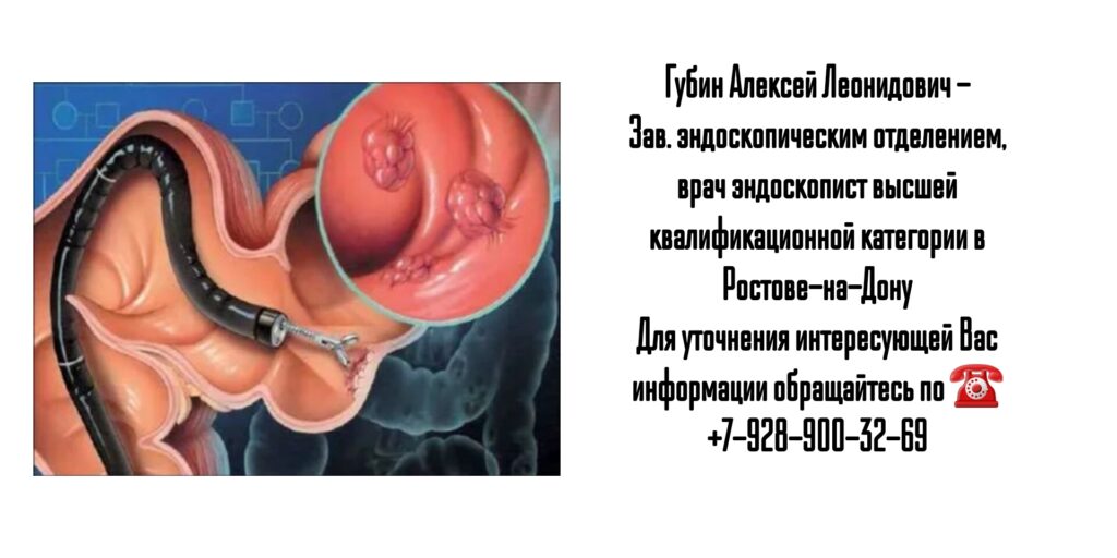 Губин Алексей Леонидович - колоноскопия в Ростове-на-Дону