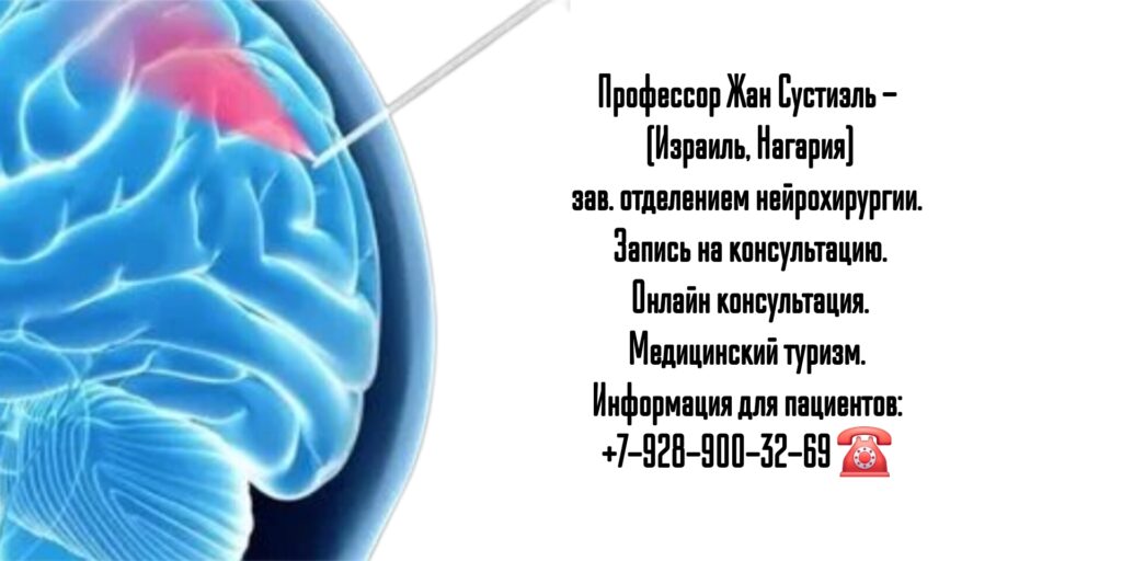 Профессор Жан Сустиэль - нейрохирург Израиль 