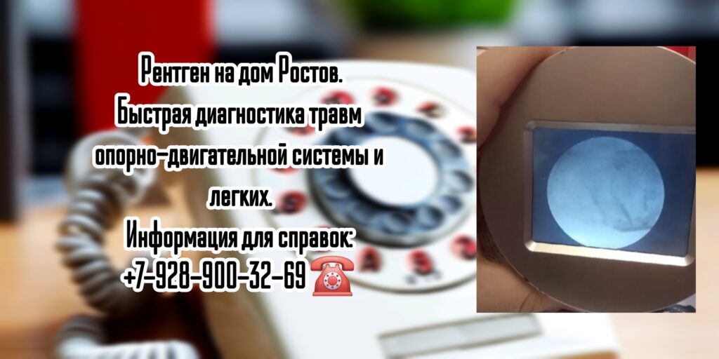 Рентген на дому Ростов с помощью ЭОП