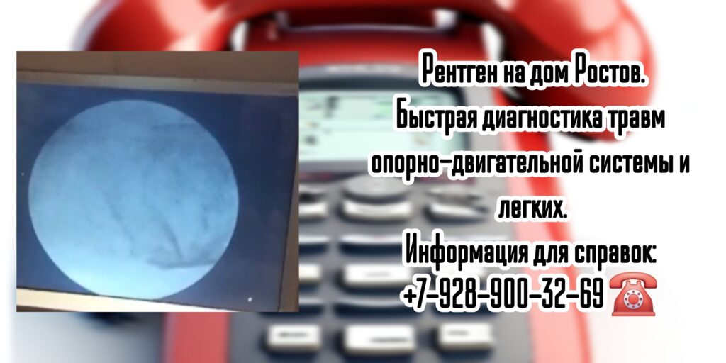 Рентген на дому Ростов с помощью ЭОП