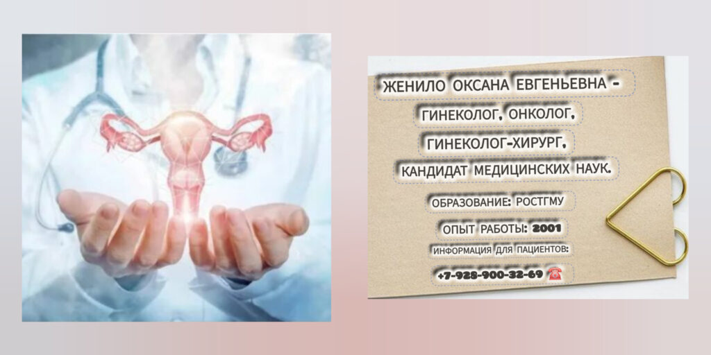 Врач онкогинеколог в Ростове-на-Дону- Женило Оксана Евгеньевна