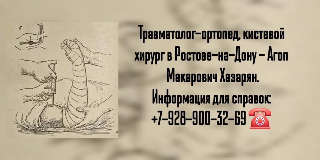 Агоп Макарович Хазарян - травматолог- ортопед Ростов 