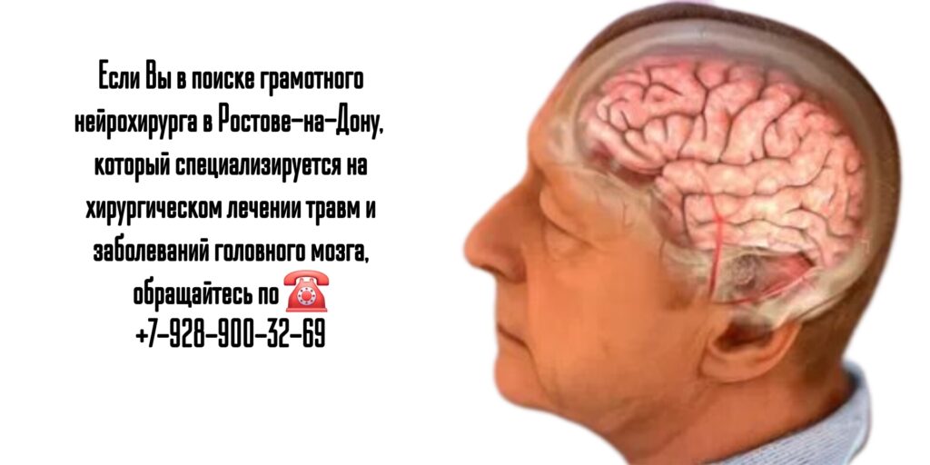 Молдованов Владимир Архипович- запись на прием к нейрохирургу Ростов 