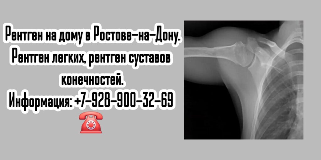 Ростов Рентген на дом- вызов специалиста 