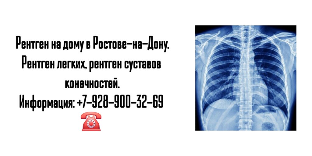Ростов Рентген на дом- вызов специалиста 