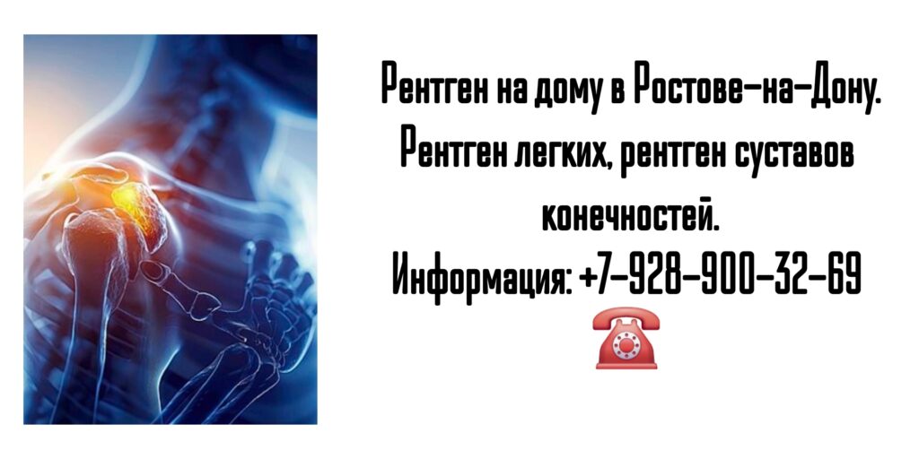 Ростов Рентген на дом- вызов специалиста 