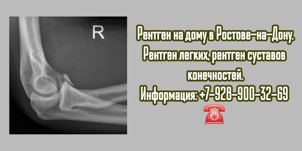 Ростов Рентген на дом- вызов специалиста 