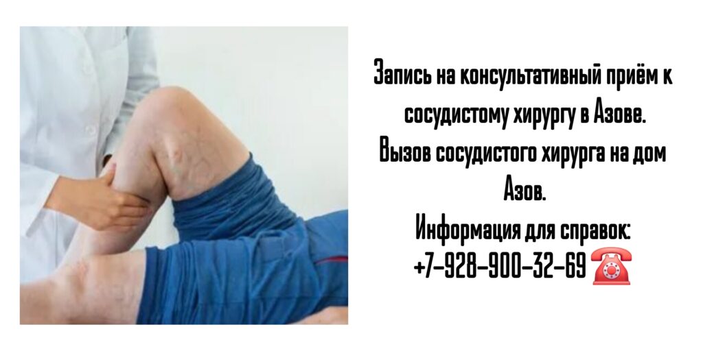 Азов сосудистый хирург - Месхишвили Георгий Николаевич