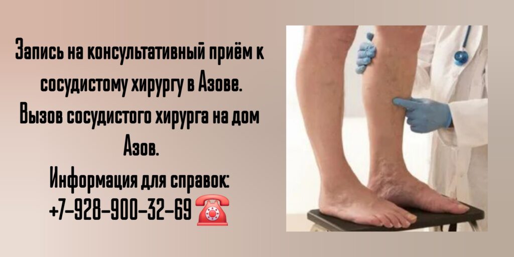 Азов сосудистый хирург - Месхишвили Георгий Николаевич