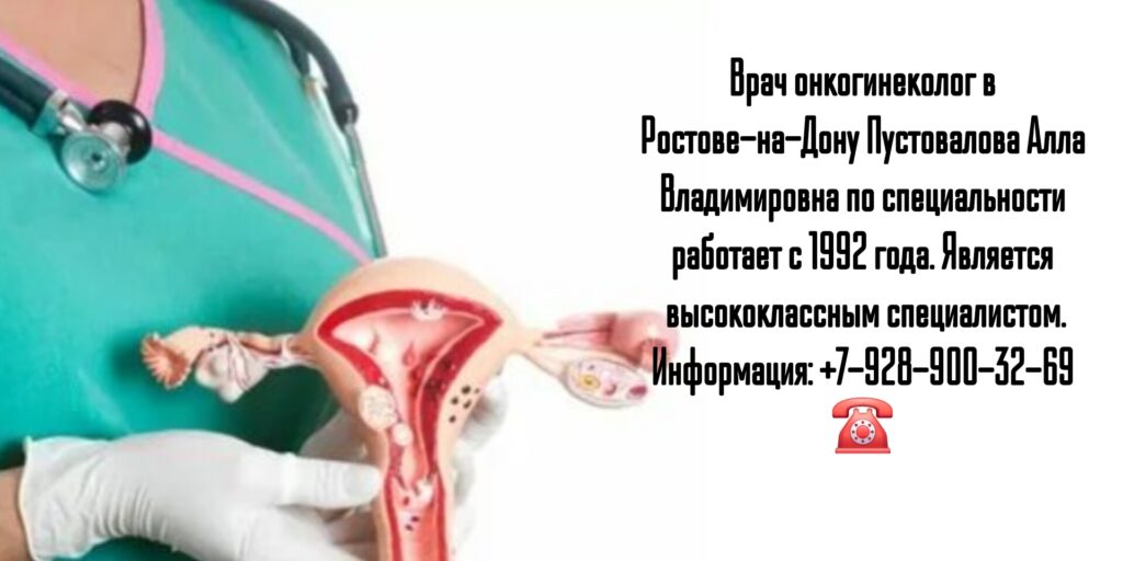 Пустовалова Алла Владимировна - онколог гинеколог Ростов