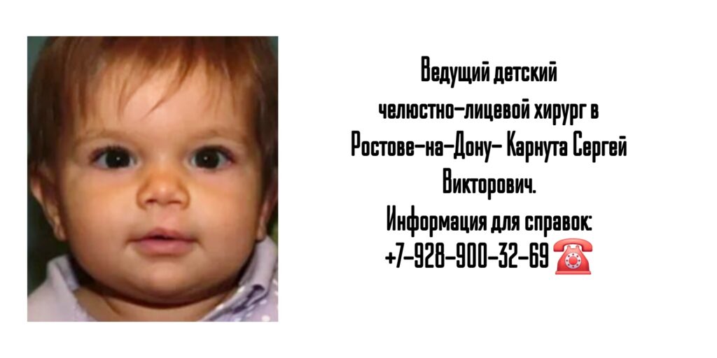 Карнута Сергей Викторович - челюстно-лицевой хирург детский Ростов- Расщелина верхнего мягкого неба