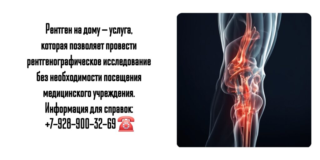Рентген - как сделать на дому в Ростове-на-Дону?