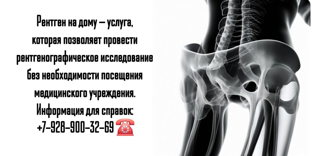 Рентген - как сделать на дому в Ростове-на-Дону?