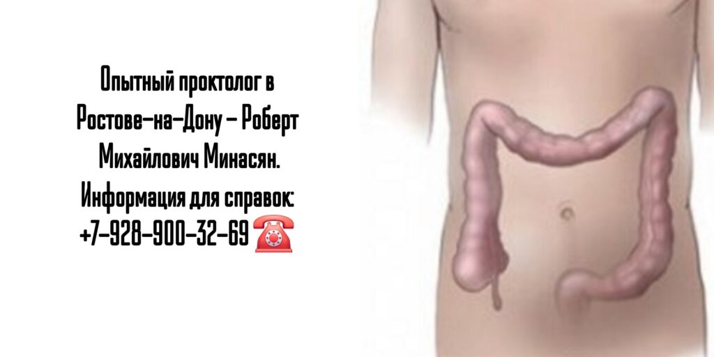 Минасян Роберт Михайлович - лечение геморроя Ростов 