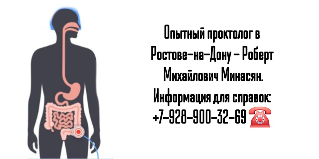 Минасян Роберт Михайлович - лечение геморроя Ростов 