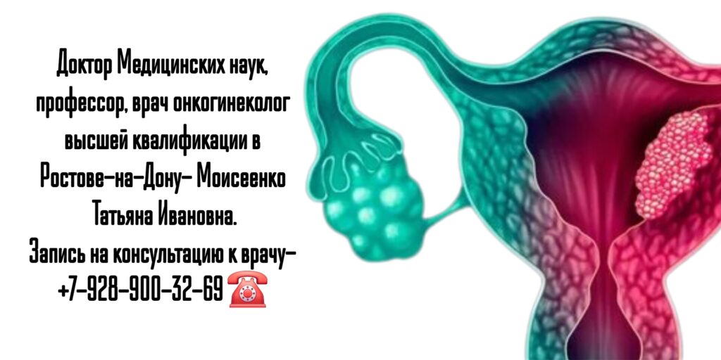 Опытный онколог гинеколог Ростов- Татьяна Ивановна Моисеенко 