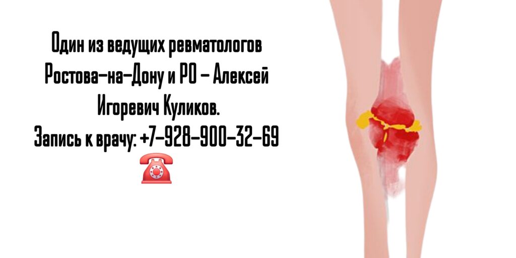 Как найти хорошего ревматолога в Ростове-на-Дону? - Куликов Алексей Игоревич 
