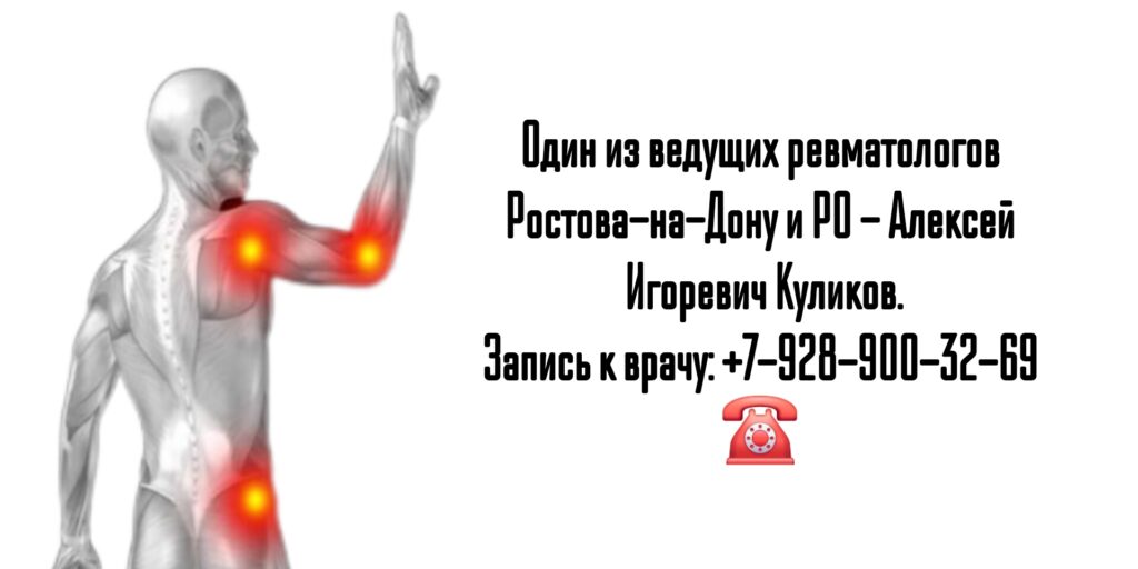 Как найти хорошего ревматолога в Ростове-на-Дону? - Куликов Алексей Игоревич 