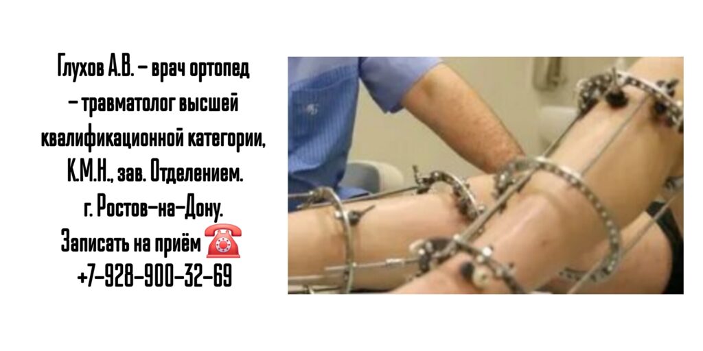 Глухов Сергей Вячеславович- Запись к травматологу Ростов-на-Дону 