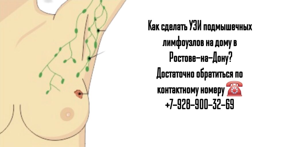 УЗИ подмышечных лимфоузлов на дому в Ростове-на-Дону