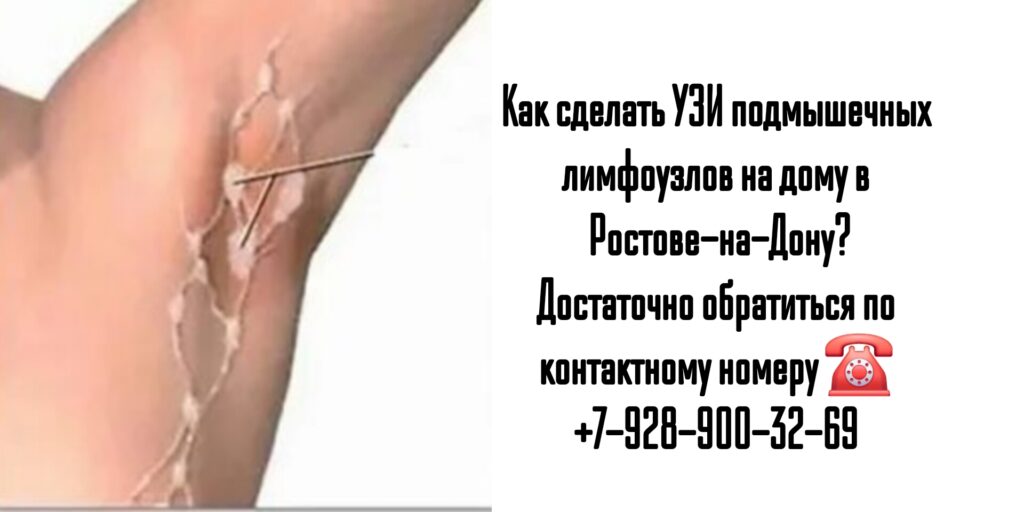 УЗИ подмышечных лимфоузлов на дому в Ростове-на-Дону