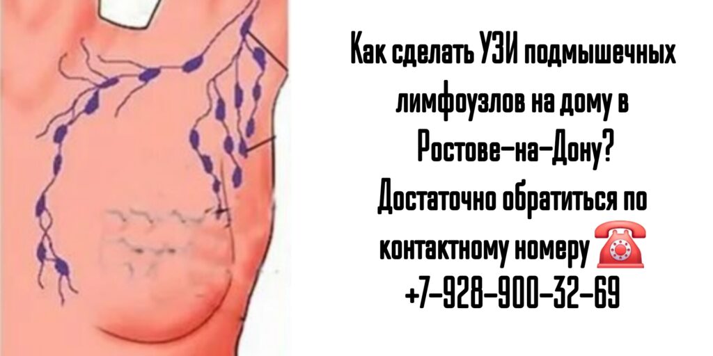 УЗИ подмышечных лимфоузлов на дому в Ростове-на-Дону