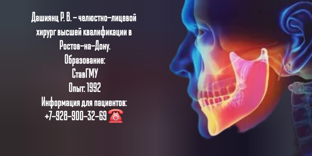 Дашиянц Руслан Вахаевич - челюстно-лицевой хирург Ростов-на-Дону 