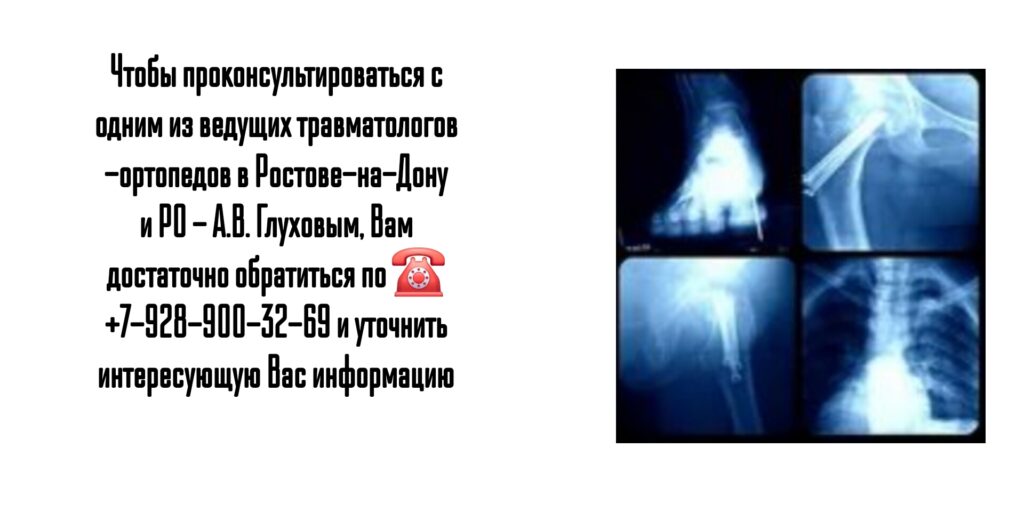 Ростов травматолог - Глухов Алексей Вячеславович