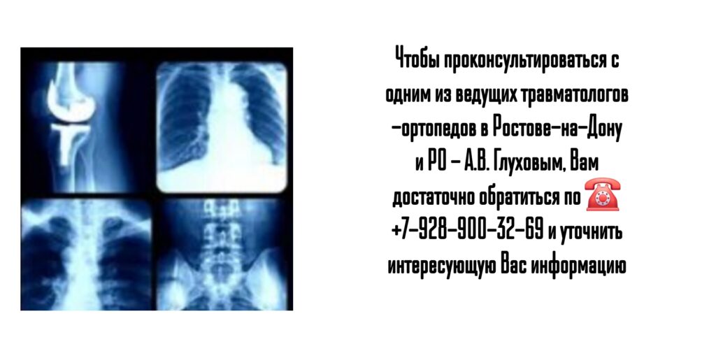 Ростов травматолог - Глухов Алексей Вячеславович