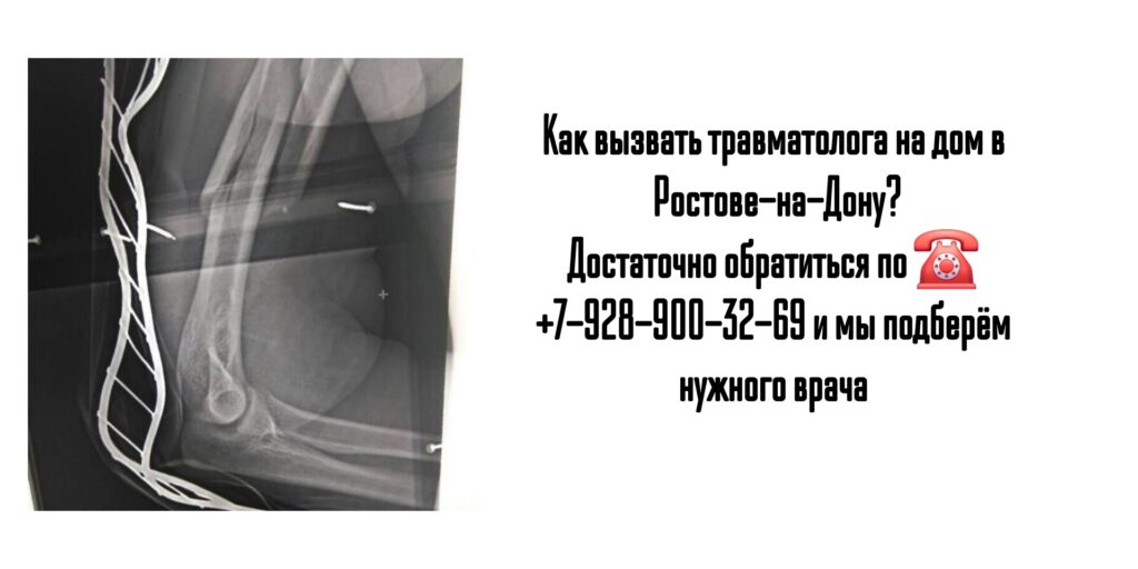Вызов травматолога на дом в Ростове-на-Дону