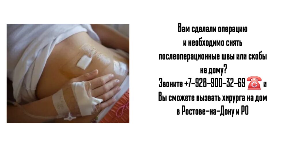 Снятие послеоперационных швов на дому - Ростов-на-Дону и РО 