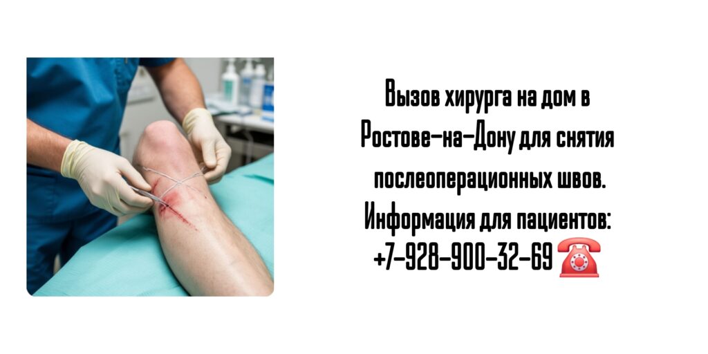 Вызов хирурга на дом Ростов- снятие послеоперационных швов