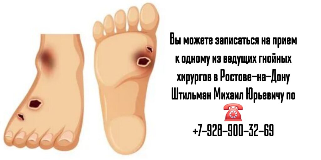 Штильман Михаил Юрьевич- запись на прием к гнойному хирургу в Ростове-на-Дону 
