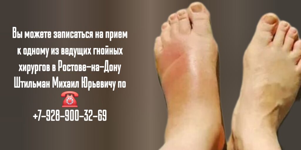 Штильман Михаил Юрьевич- запись на прием к гнойному хирургу в Ростове-на-Дону 