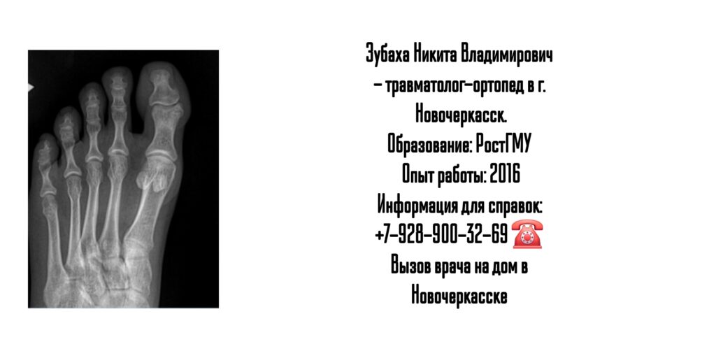 Зубаха Никита Владимирович- врач травматолог-ортопед в Новочеркасске 