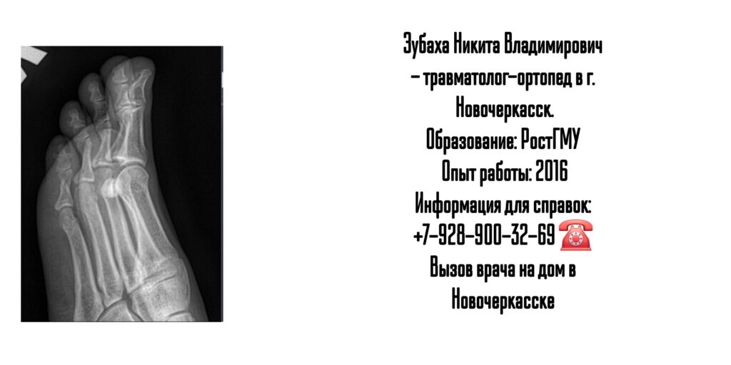Зубаха Никита Владимирович- врач травматолог-ортопед в Новочеркасске 