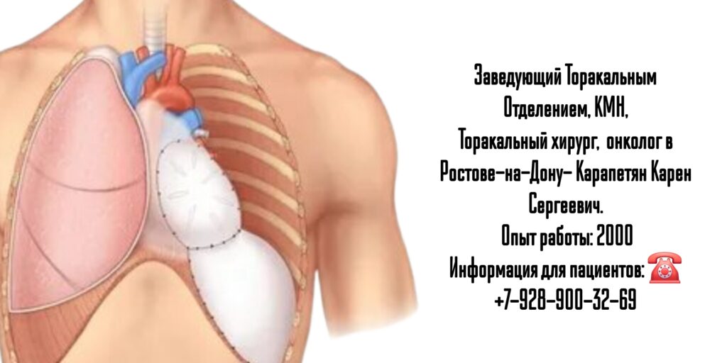Торакальный онколог - хирург в Ростове-на-Дону - Карапетян Карен Сергеевич 