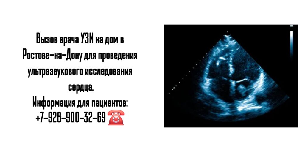 Узи сердца на дому в Ростове-на-Дону