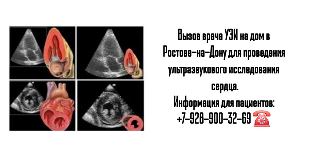 Узи сердца на дому в Ростове-на-Дону