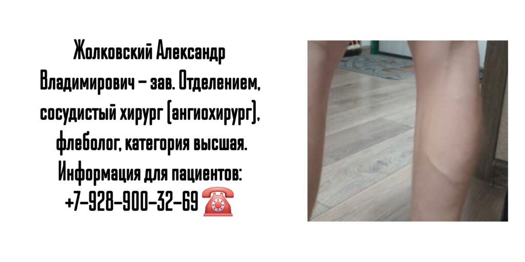 Сосудистый хирург Ростов - Жолковский Александр Владимирович 