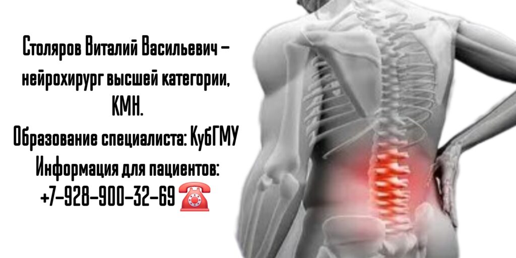 Ростов ведущий нейрохирург Столяров В.В.