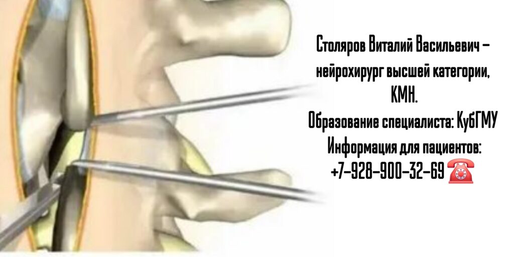 Ростов ведущий нейрохирург Столяров В.В.