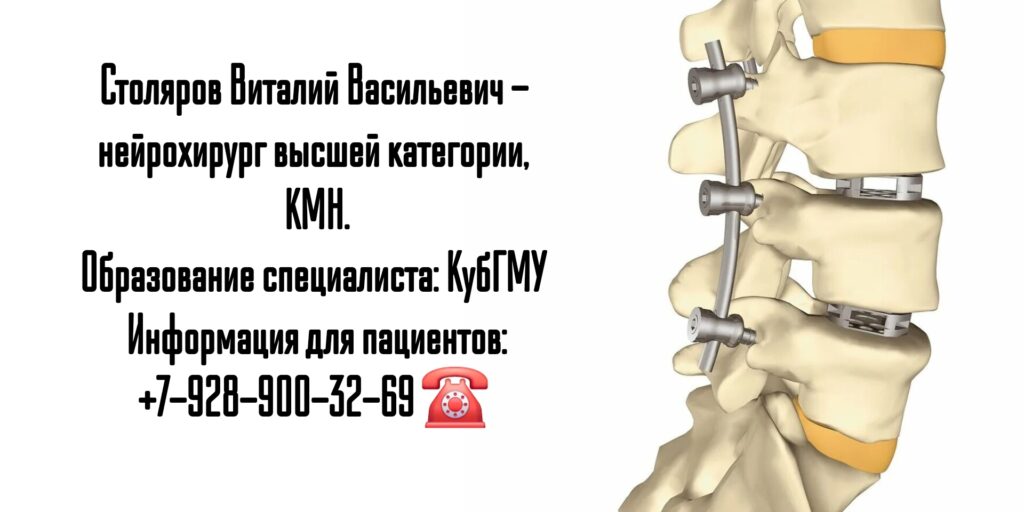 Ростов ведущий нейрохирург Столяров В.В.